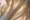 Botox i helsingborg