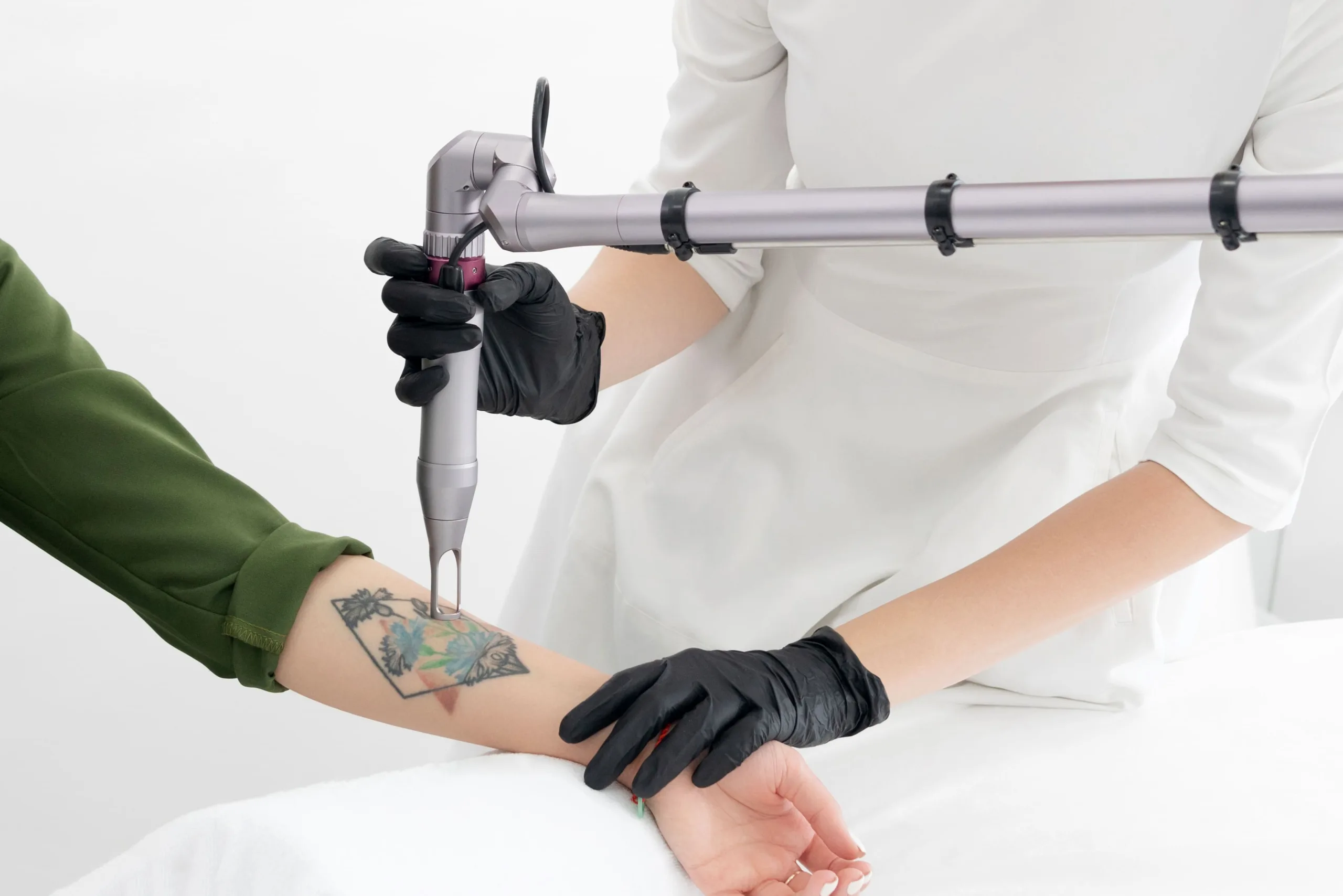 tatueringsborttaging i helsingborg